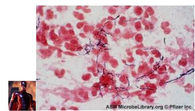 Imagen de Nocardia al microscopio